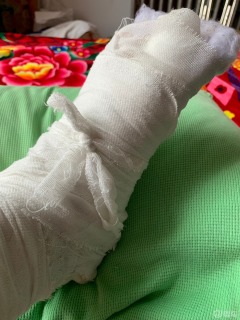 现代车不仅问题多,去修车4s店把我脚压伤还不负责任,真是寒心!